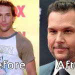 Dane Cook Plastic Surgery Photos Before After