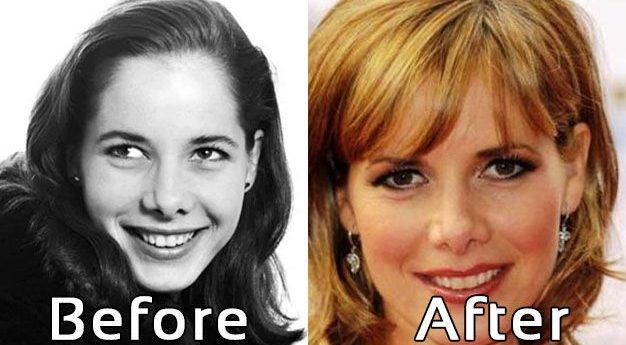 Amy Yancey Before Plastic Surgery - Flipping Vegas - Photos