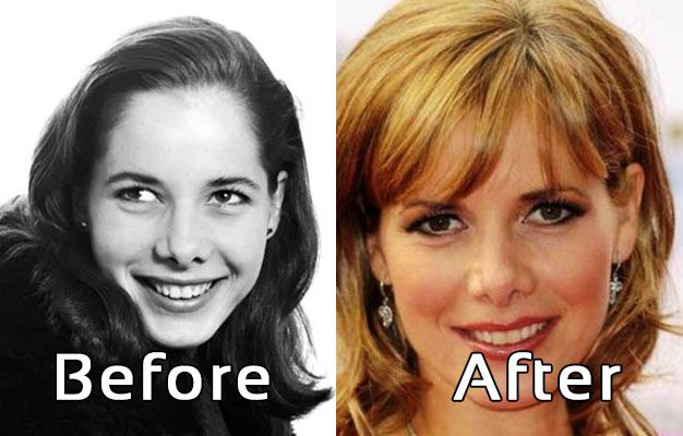 Did Darcey Bussel Have A Nose Job? Before & After Photos!