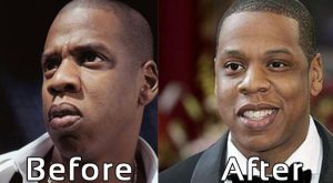 Jay-Z Nose Job Plastic Surgery Photos Before After
