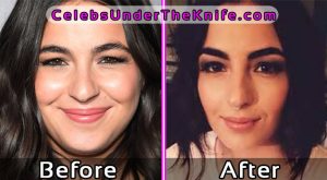 Alanna Masterson Before and After Photos