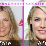 Ali Larter Pics Before and After Plastic Surgery