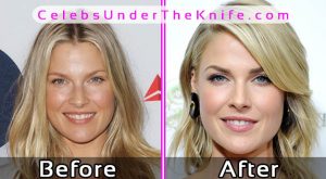 Ali Larter Pics Before and After Plastic Surgery