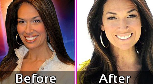 Aloha Taylor Photos – Before and After Plastic Surgery?