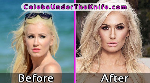 Ana Braga Pics Before and After Plastic Surgery