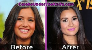 Catherine Giudici Plastic Surgery Before After Photos