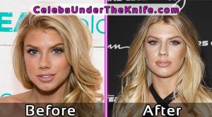 Charlotte McKinney Photos Plastic Surgery Before After