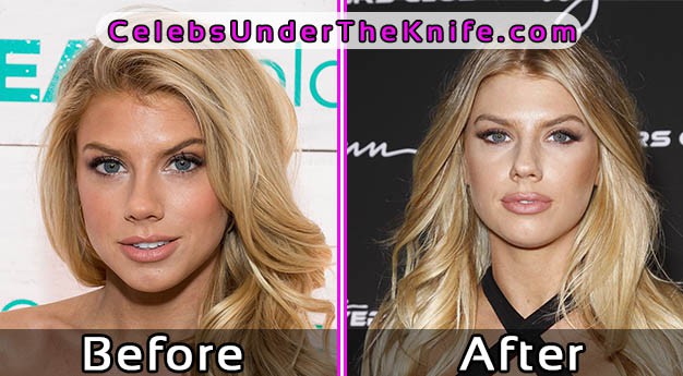 Charlotte McKinney Plastic Surgery Photos Before After