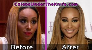 Cynthia Bailey Before and After Plastic Surgery