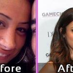 Danielle Jonas Nose Job Before After Photos