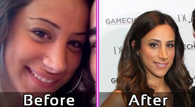 Danielle Jonas Nose Job Before After Photos