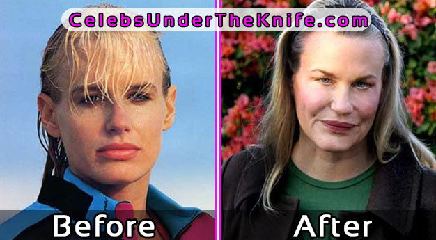 Daryl Hannah - Plastic Surgery Fails Pics