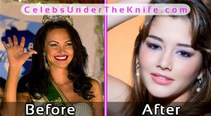 Juliana Borges Plastic Surgery Before After Photos