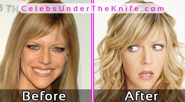 Kaitlin Olson Before After Plastic Surgery Pics