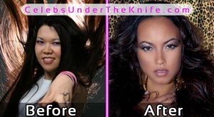 Kimberly Goss Before and After Plastic Surgery Photos