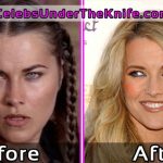 Lucy Lawless Plastic Surgery Photos