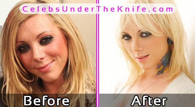 Maria Brink Plastic Surgery Photos Before After