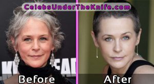 Melissa McBride Before and After Photos