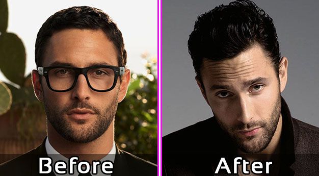 Noah Mills Plastic Surgery Before and After Photos