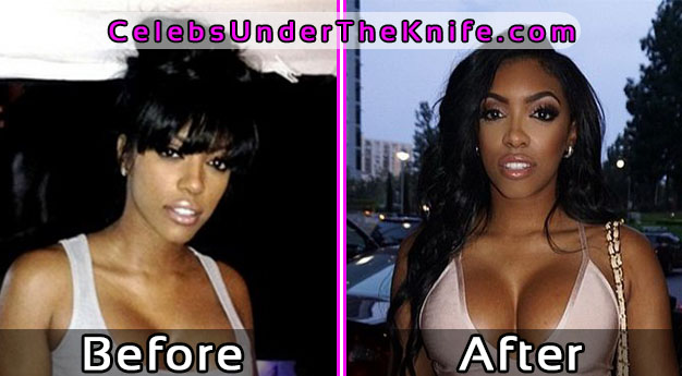 Porsha Williams Photos – Before and After Plastic Surgery