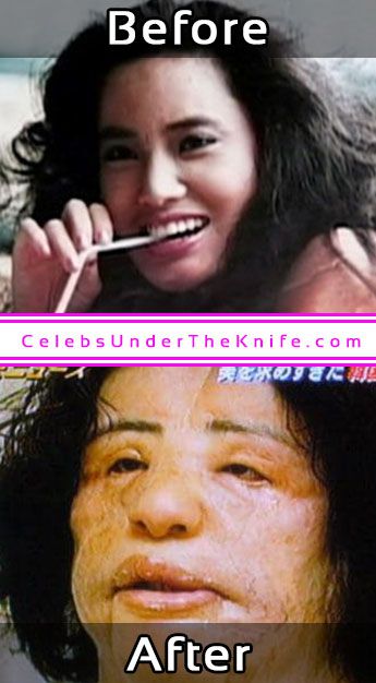 Hang Mioku Plastic Surgery Cooking Oil Disaster