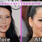 Lucy Liu Plastic Surgery Before After Photos