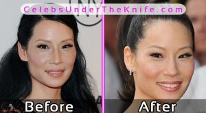 Lucy Liu Plastic Surgery Before After Photos