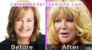 Marilyn Denis Plastic Surgery Photos Before After