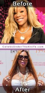 Wendy Williams Photos Before After