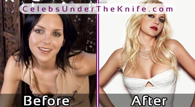 Anna Faris Before After Boob Job