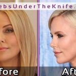 Charlize Theron Nose Job Before After Photos