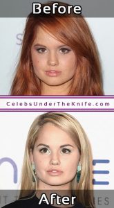 Debby Ryan Plastic Surgery Photos Before After