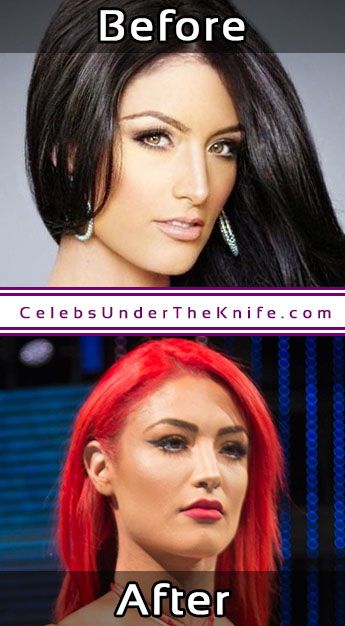 Eva Marie Nose Job Before After Surgery