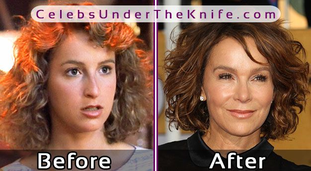 Jennifer Grey Nose Job – Photos Before & After Plastic Surgery
