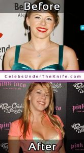 Jodie Sweetin Before After Plastic Surgery