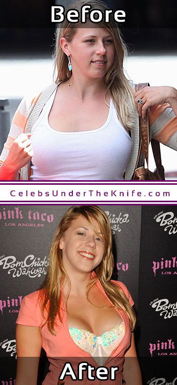 Jodie Sweetin Boob Enhancements.