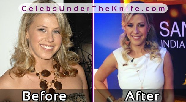 Jodie Sweetin Boob Job Photos