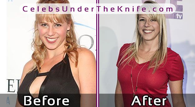 Jodie Sweetin Boob Job? 