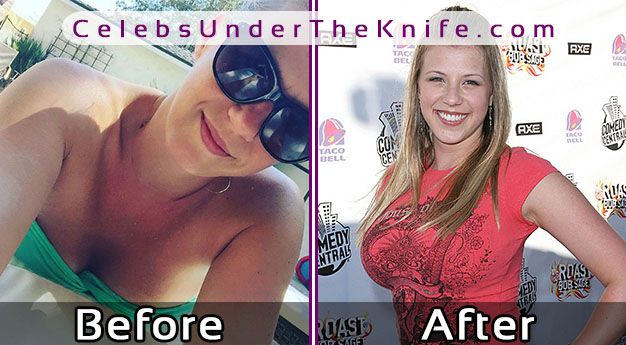 Jodie Sweetin Plastic Surgery Photos