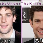 John Krasinski Nose Job Photos   Before After