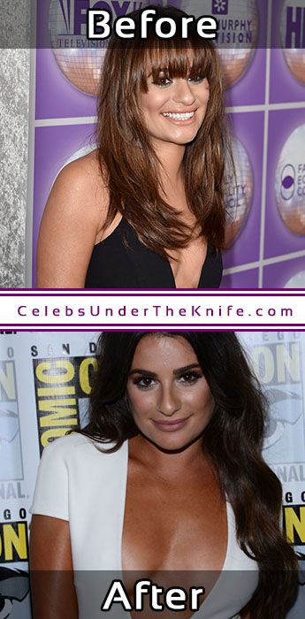 Lea Michele Before After Boob Job Rumors