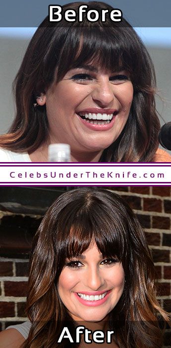 Lea Michele Potential Chin Job