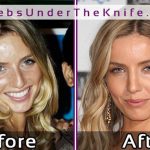 Annabelle Wallis Nose Job Photos