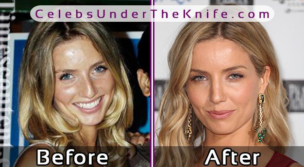 Annabelle Wallis Nose Job Photos