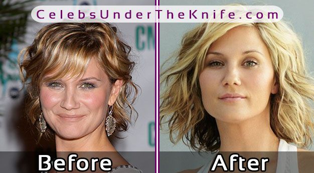 Jennifer Nettles Before After Photos