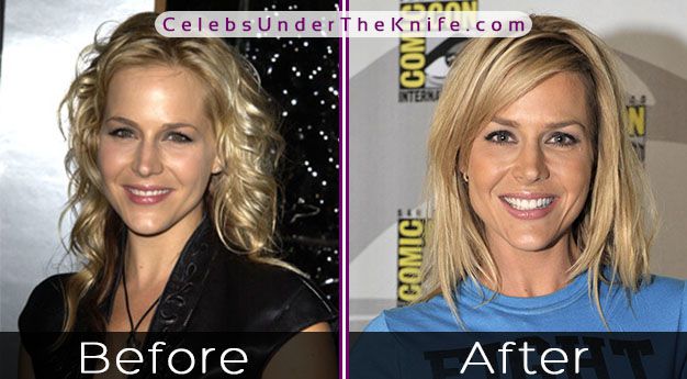 Julie Benz Before After Photos.