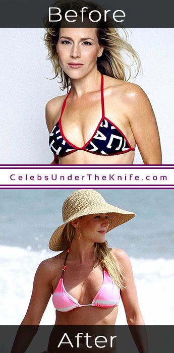 Julie Benz Breast Enhancement Photos