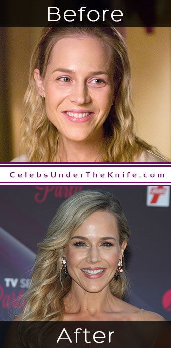 julie benz before and after implants