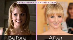 Melissa Rauch Before and After