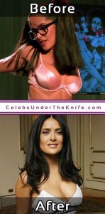 Salma Hayek Breast Enhancement Pictures